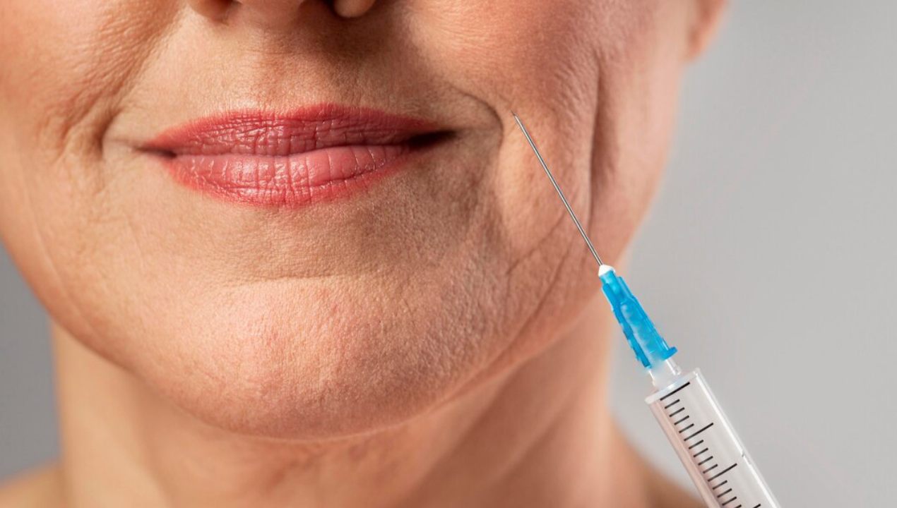 Botox Treatment