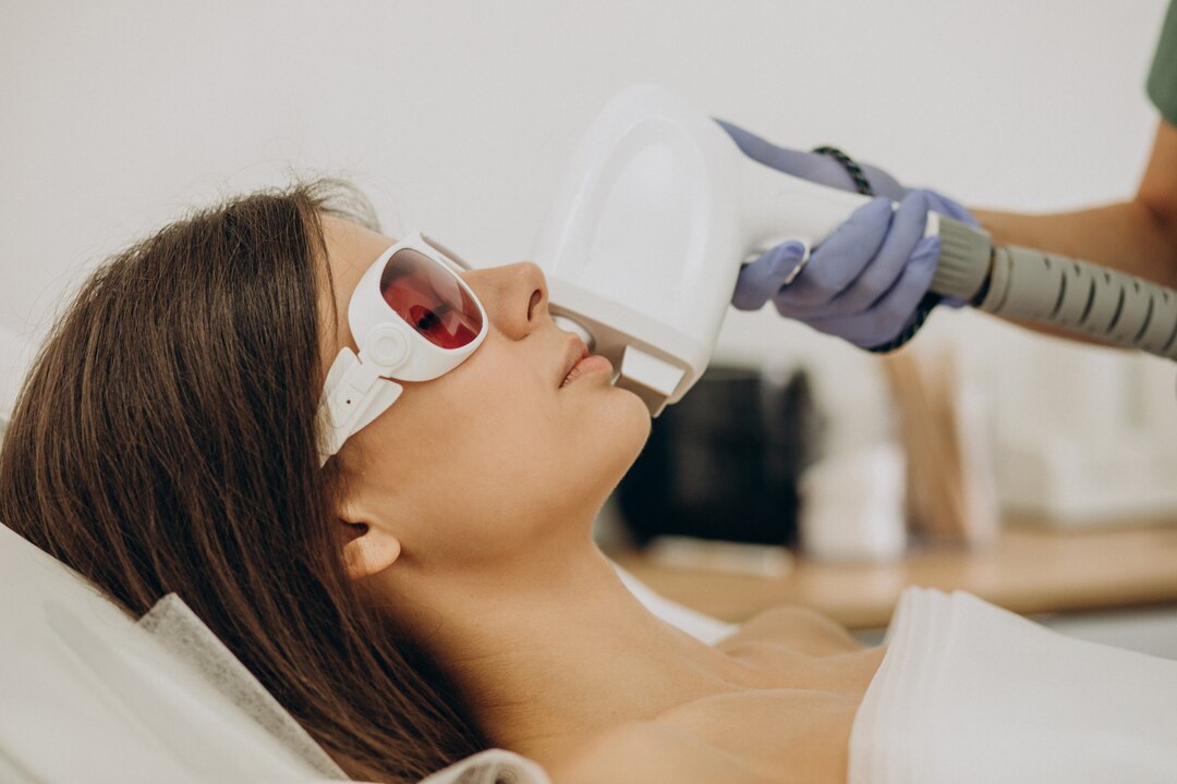 Excimer Laser Treatment