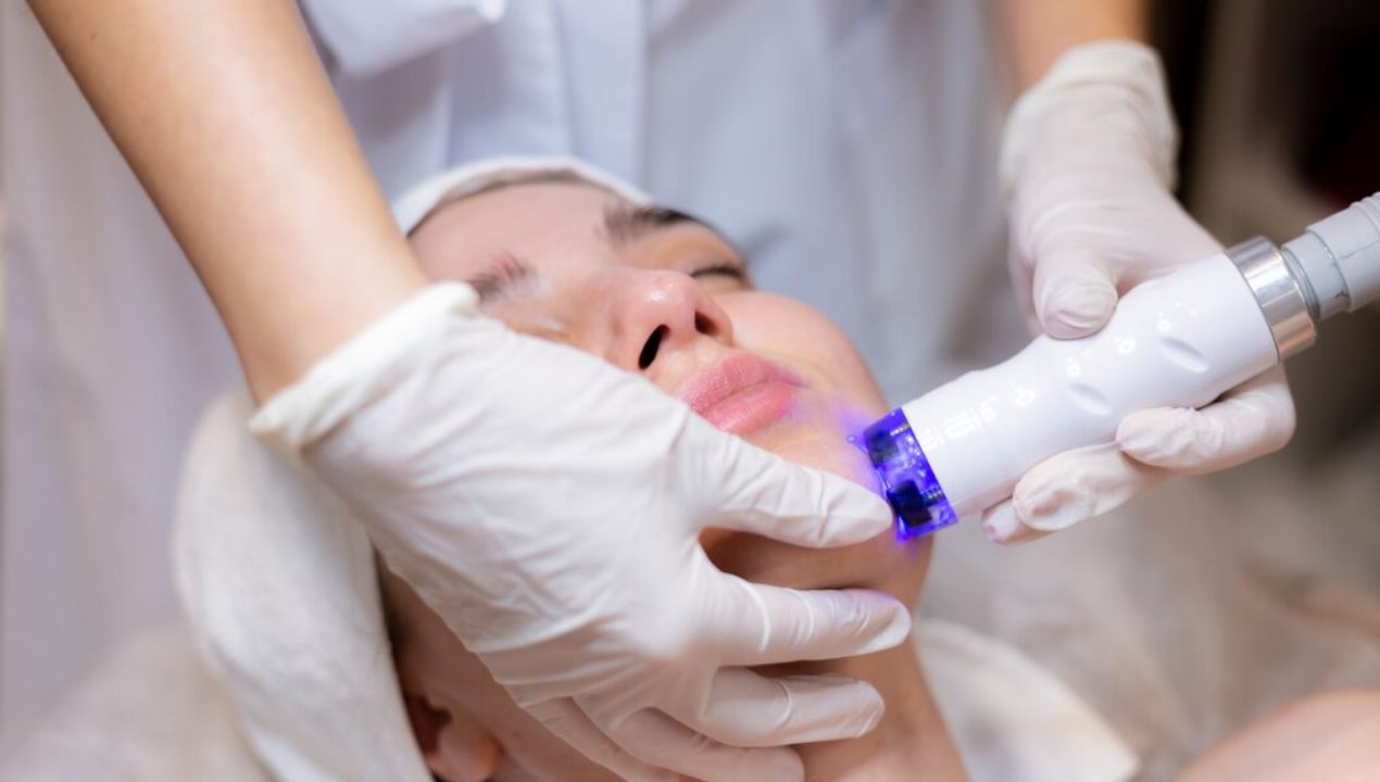 Q-Switch Laser Treatment