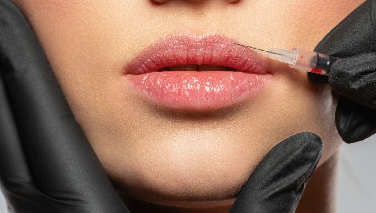 Skin Booster Injection placing on face