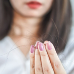 A woman showing her hair fall